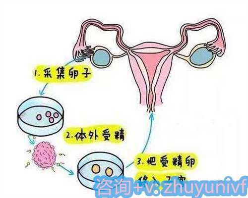 代生男孩价格，[签约做试管婴儿包成功]难孕女性输卵管堵塞可做试管婴儿吗